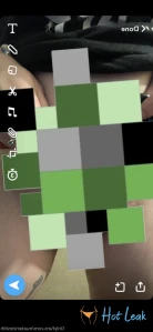6294331