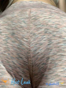 11925294