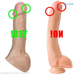 6245867