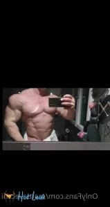 4259309