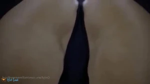 8891572