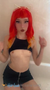 4918179