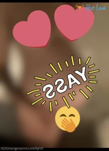 2844715
