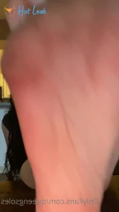 8844635