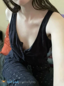 2871332
