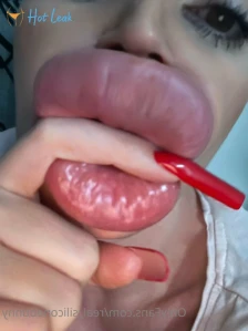 5809849