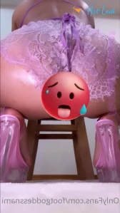 5524446