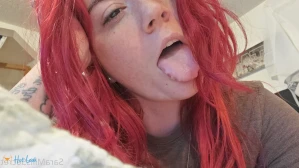 6251772