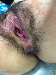 2659723
