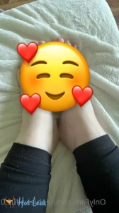 2657732