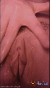 2657636