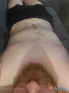 5861778
