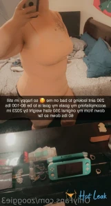 6172763