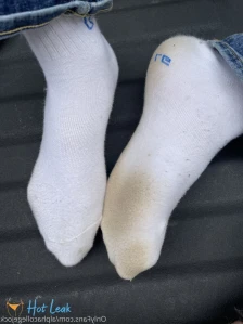 5686870
