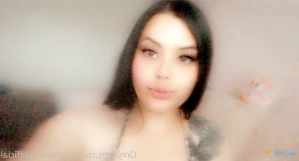 5662618