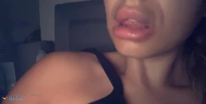 11034401