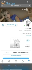 5628658