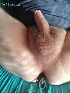 5855864