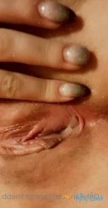 4995659