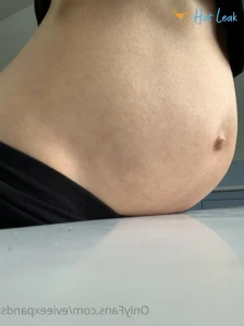 5750670