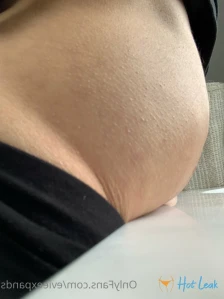 5750887