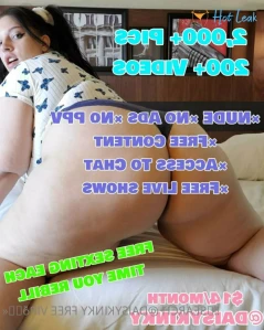 5572389