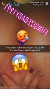 5743516