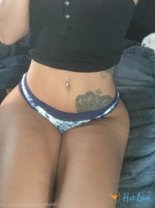 5770177