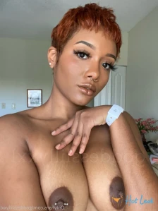 5593665
