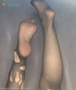 5561864