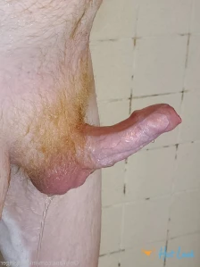5586520