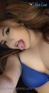 5581954