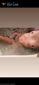 5555418