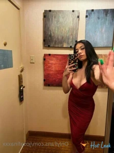 5564420