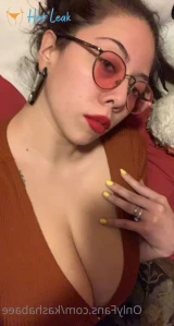 5549562