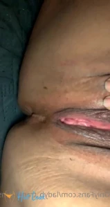 5170572