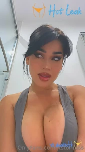 11836887