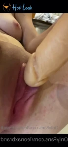 5176612