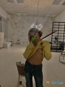 5633872