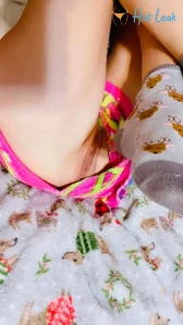 5587915