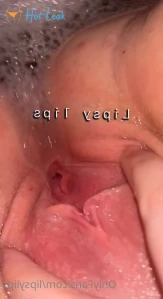 5181794