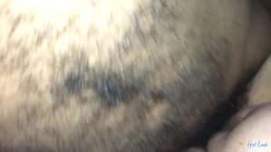 5236718