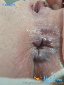 11769752