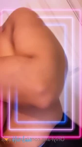 8657381