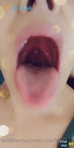 8656986