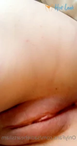 5331237