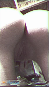 8636922