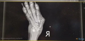 4859288