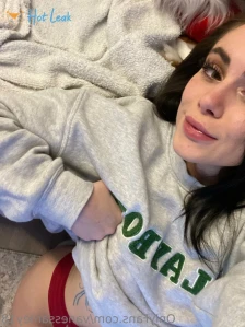 9310594