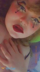 11408425